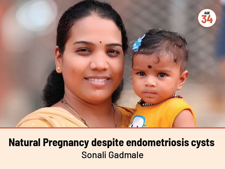 Natural Pregnancy despite endometriosis cysts Sonali Gadmale